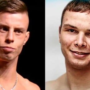 El impactante antes y después de dos peleadores de MMA por una pelea