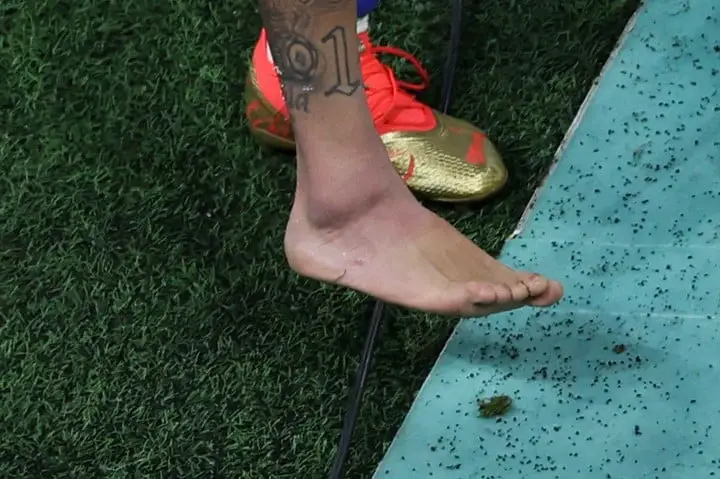 El tobillo derecho de Neymar luego de partido ante Serbia (AFP).